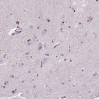 Anti-HSPA2 Antibody