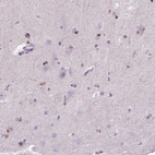 Immunohistochemical staining of human cerebral cortex shows moderate nuclear positivity in glial cells.