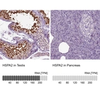 Immunohistochemical staining of human pancreas shows no positivity in exocrine glandular cells as expected.