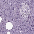 Immunohistochemical staining of human testis shows moderate nuclear positivity in cells in seminiferous ducts.