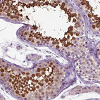 Immunofluorescence staining of mouse brain shows moderate to strong positivity in more than 75 % of neurons in the thalamus.