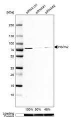 Anti-HSPA2 Antibody