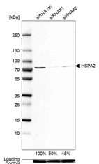 Western blot analysis in A-549 cells transfected with control siRNA, target specific siRNA probe #1 and #2, using Anti-HSPA2 antibody. Remaining relative intensity is presented. Loading control: Anti-GAPDH.