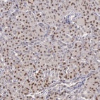 Anti-GRK3 Antibody