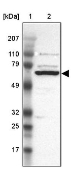Lane 1: Marker [kDa] 207, 110, 79, 49, 32, 25, 17_br/_Lane 2: Human cell line RT-4
