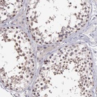 Anti-BRD1 Antibody