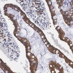 Anti-WDR89 Antibody