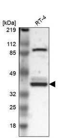 Western blot analysis in human cell line RT-4.