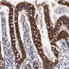 Anti-AMN Antibody