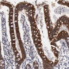 Anti-AMN Antibody