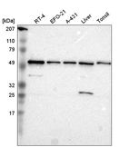 Western blot analysis in human cell line RT-4, human cell line EFO-21, human cell line A-431, human liver tissue and human tonsil tissue.