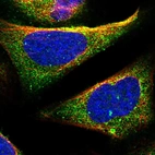 Immunofluorescent staining of human cell line U-2 OS shows localization to cytosol.