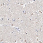 Anti-ASPHD2 Antibody