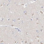 Anti-ASPHD2 Antibody