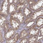 Anti-TRMU Antibody