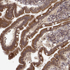 Anti-TRMU Antibody