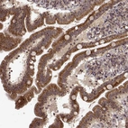 Immunohistochemical staining of human duodenum shows strong granular cytoplasmic positivity in glandular cells.