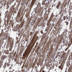 Anti-TRMU Antibody