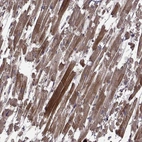 Immunohistochemical staining of human heart muscle shows moderate cytoplasmic positivity in cardiomyocytes.