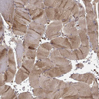 Anti-TRMU Antibody