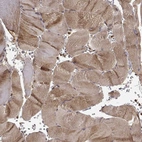 Immunohistochemical staining of human skeletal muscle shows moderate cytoplasmic positivity in myocytes.