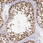 Immunohistochemical staining of human testis shows strong nuclear positivity in cells in seminiferous ducts.