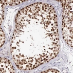 Immunohistochemical staining of human testis shows strong nuclear positivity in cells in seminiferous ducts.