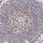 Immunohistochemical staining of human lymph node shows strong nuclear positivity in germinal center cells.