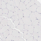 Immunohistochemical staining of human skeletal muscle shows very weak nuclear positivity in myocytes.