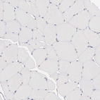 Anti-CCDC117 Antibody