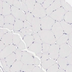 Immunohistochemical staining of human skeletal muscle shows very weak nuclear positivity in myocytes.