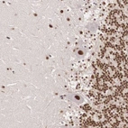 Anti-POLR2F Antibody