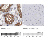 Anti-G6PD Antibody