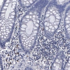 Immunohistochemical staining of human colon shows moderate cytoplasmic positivity in a subset of lymphoid cells.