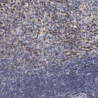 Immunohistochemical staining of human spleen shows moderate cytoplasmic positivity in lymphoid cells.