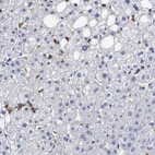 Immunohistochemical staining of human liver shows moderate to strong cytoplasmic positivity in Kupffer cells.