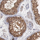 Immunohistochemical staining of human testis shows strong cytoplasmic positivity in cells in seminiferous ducts.