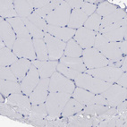Immunohistochemical staining of human skeletal muscle shows no cytoplasmic positivity in myocytes as expected.
