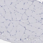 Immunohistochemical staining of human skeletal muscle shows no cytoplasmic positivity in myocytes as expected.