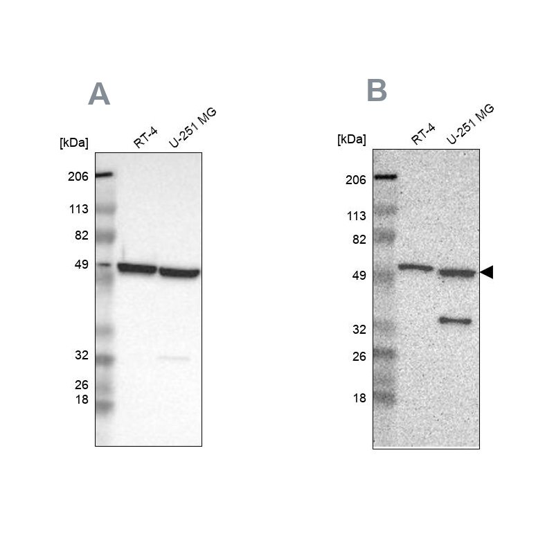 Rabbit Polyclonal AntiG6PD Antibody Buy for research Highly specific, rigorously validated