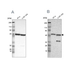 Anti-G6PD Antibody