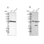 Western blot analysis using Anti-G6PD antibody HPA000834 (A) shows similar pattern to independent antibody HPA000247 (B).