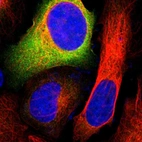 Immunofluorescent staining of human cell line U-2 OS shows positivity in cytoplasm.
