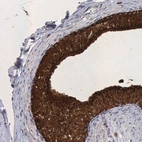 Immunohistochemical staining of human epididymis shows strong granular cytoplasmic positivity in glandular cells.