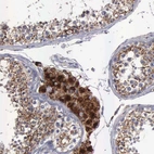 Immunohistochemical staining of human testis shows moderate to strong granular cytoplasmic positivity in Leydig cells and cells in seminiferous ducts.