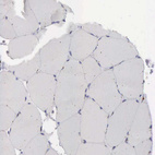 Immunohistochemical staining of human skeletal muscle shows no positivity in myocytes as expected.