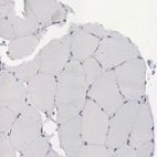 Immunohistochemical staining of human skeletal muscle shows no positivity in myocytes as expected.
