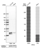 Western blot analysis in human cell lines U2OS and HeLa using Anti-NPC2 antibody. Corresponding NPC2 RNA-seq data are presented for the same cell lines. Loading control: Anti-COX4I1.