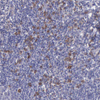 Anti-ZC3H12B Antibody