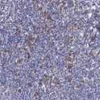 Anti-ZC3H12B Antibody